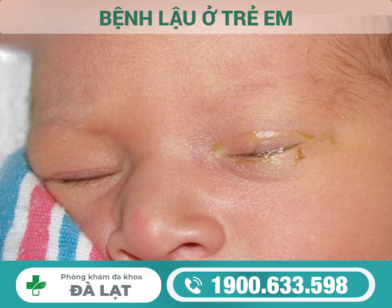 Hình ảnh minh họa